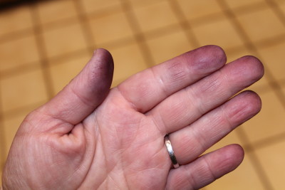 My purple stained fingers. Thankfully we hadn't invited dinner guests.